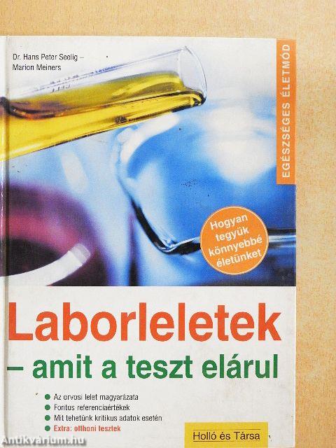 Laborleletek - amit a teszt elárul