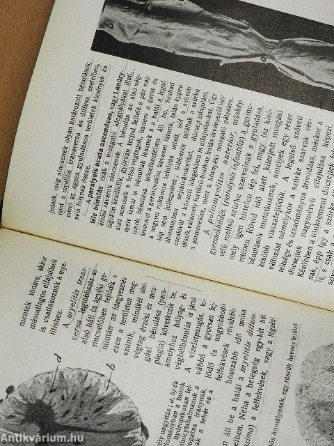 Kórboncolástan II.