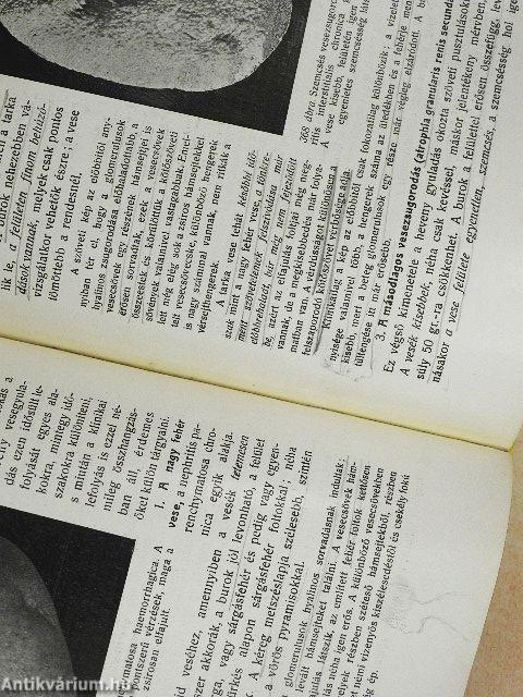 Kórboncolástan II.