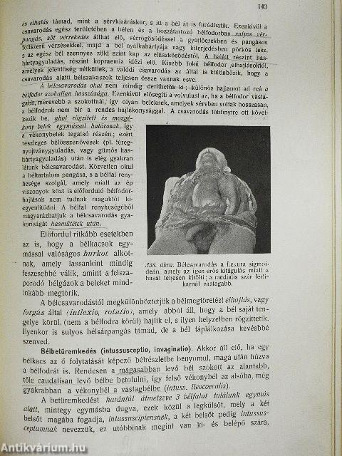 Kórboncolástan II.