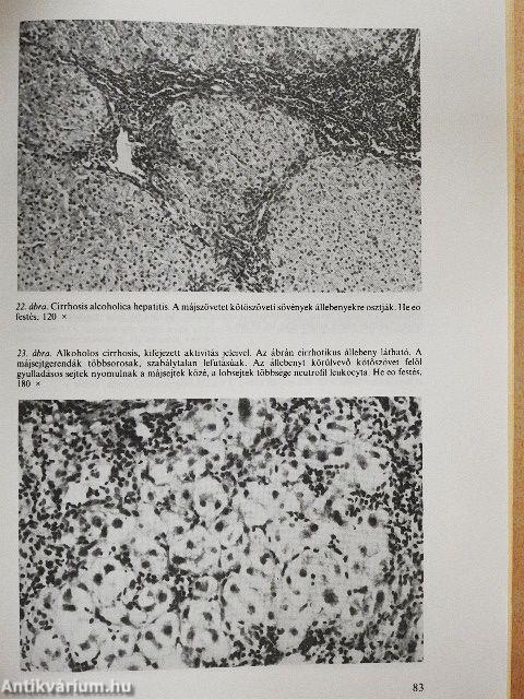 Alkoholbetegek gyógykezelése és gondozása