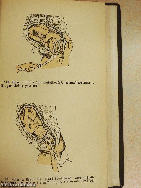 A szülészet atlasza I-II.