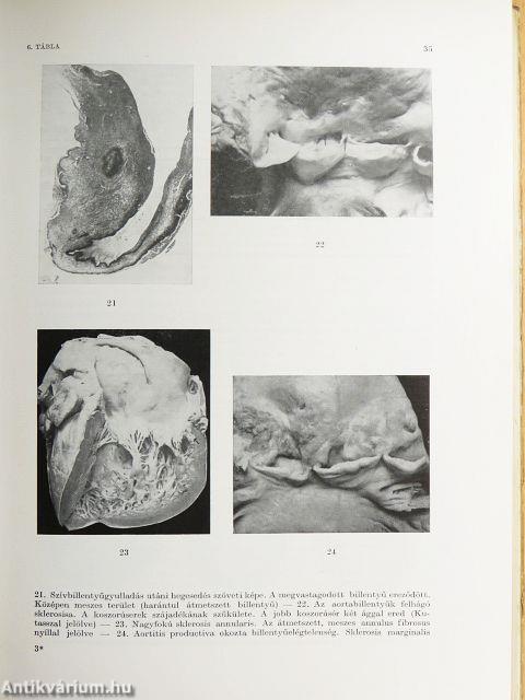 Részletes kórbonctan I.