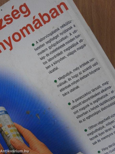 Laborleletek - amit a teszt elárul