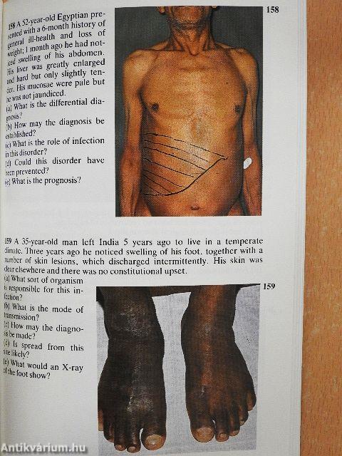 Diagnostic Picture Tests in Infectious Diseases
