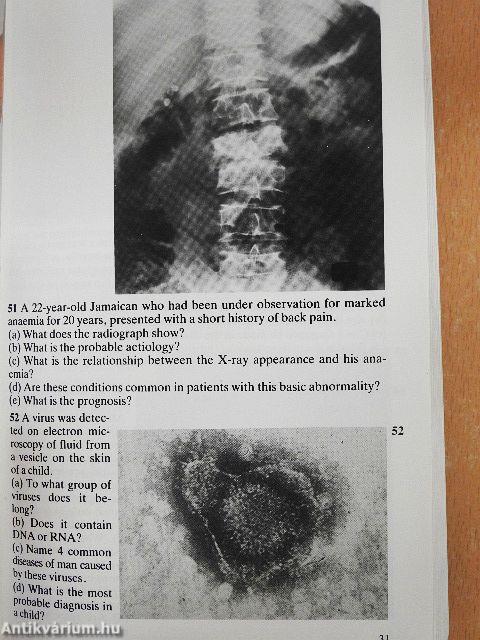 Diagnostic Picture Tests in Infectious Diseases