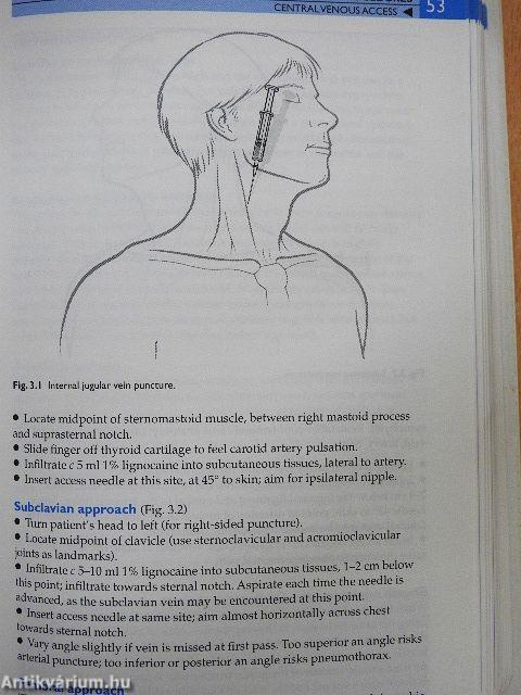 Churchill's Pocketbook of Cardiology