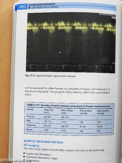 Churchill's Pocketbook of Cardiology