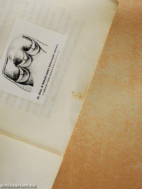 A gyógytorna szerepe a szivmütéten és a szivizominfarktuson átesett betegek rehabilitációjában