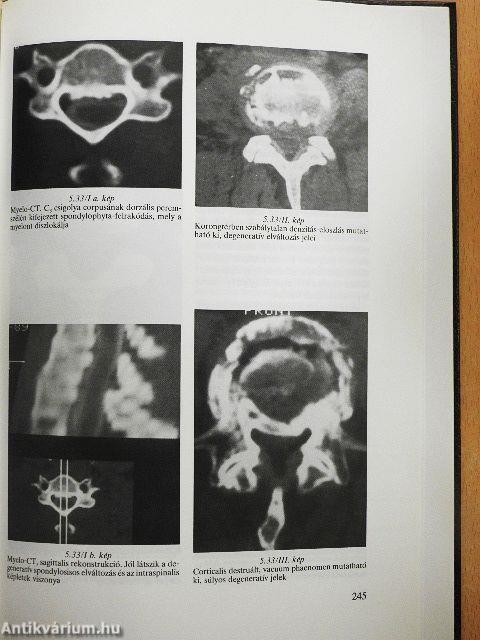 Komputertomográfia I.