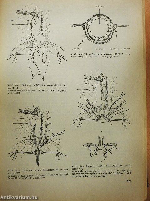 Sebészeti műtéttan