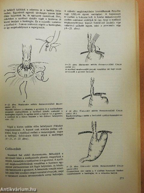 Sebészeti műtéttan