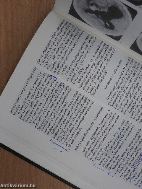 Komputertomográfia I.