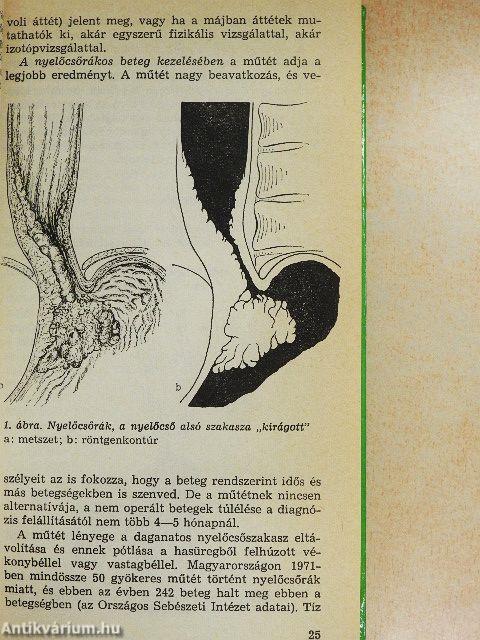 Sebészeti tudnivalók a körzeti orvosi gyakorlatban