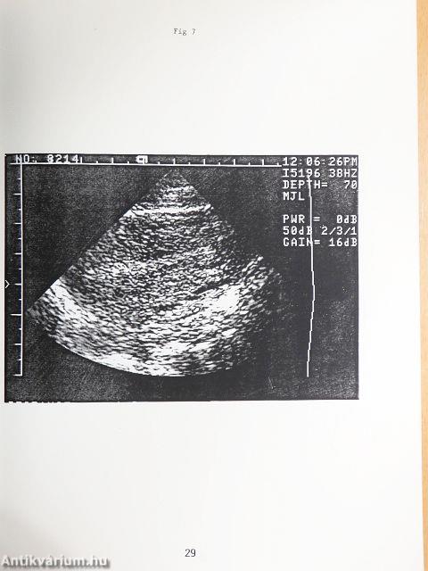 Transvaginal Sonography: Clinical Applications