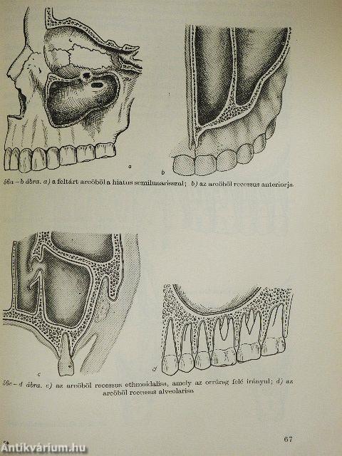 Ambuláns szájsebészet