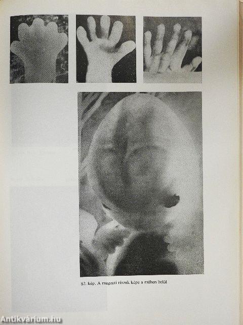 Az emberi öröklődés