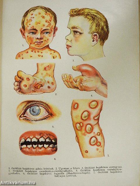 A Család egészsége