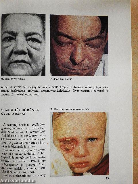 A szemészet alapvonalai 