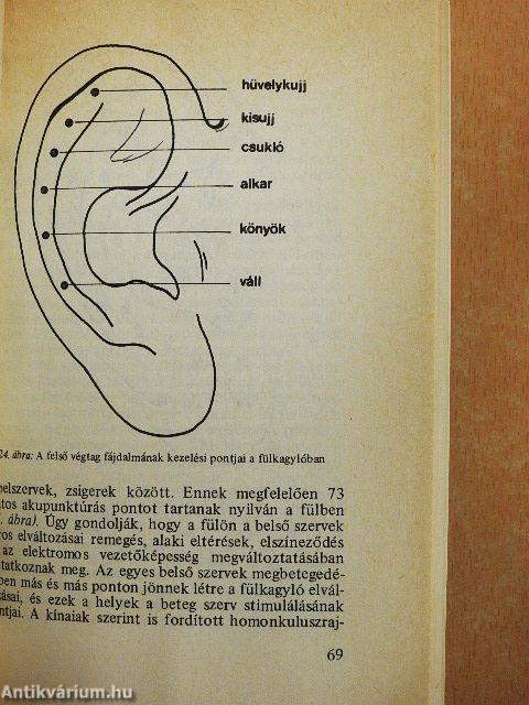 Akupunktúra és moxibusztió