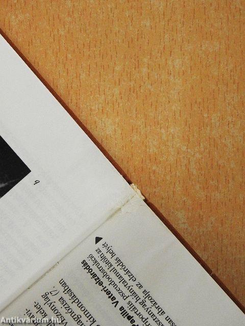 Perkután diagnosztikus és terápiás beavatkozások elzáródásos sárgaságban