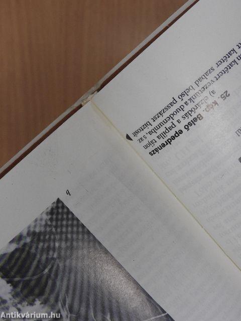 Perkután diagnosztikus és terápiás beavatkozások elzáródásos sárgaságban