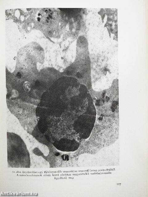 Az égési anaemia pathogenesise