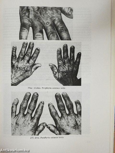 Gyakorlati bőr- és nemigyógyászat