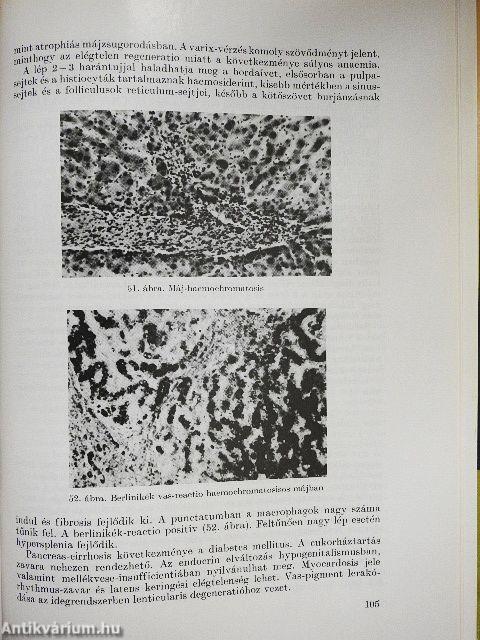 A lép belgyógyászati betegségekben