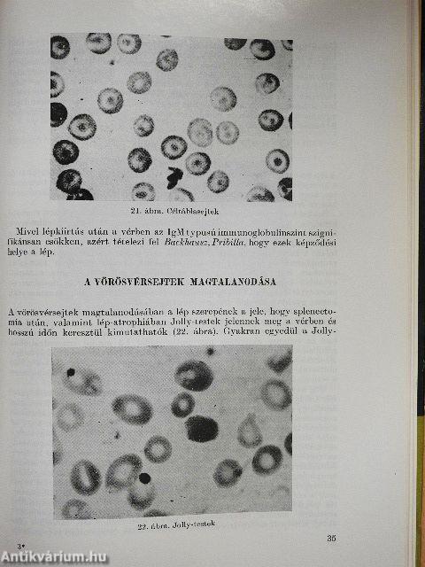 A lép belgyógyászati betegségekben