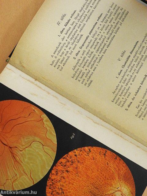 Gyakorlati szemészet