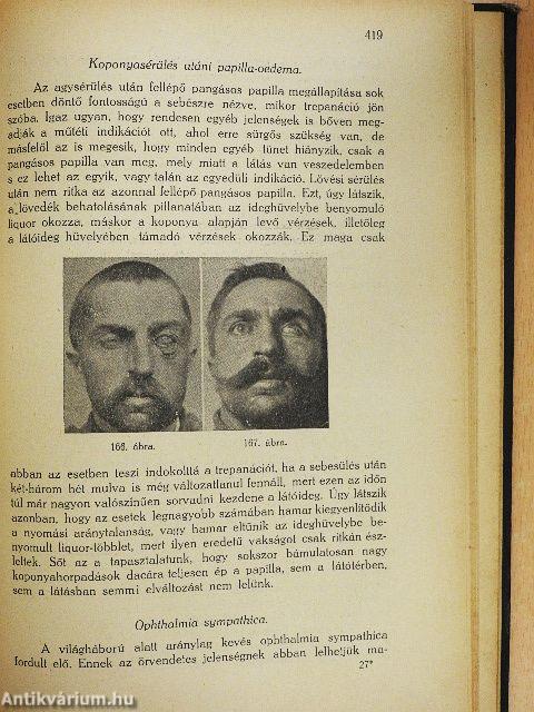 Gyakorlati szemészet