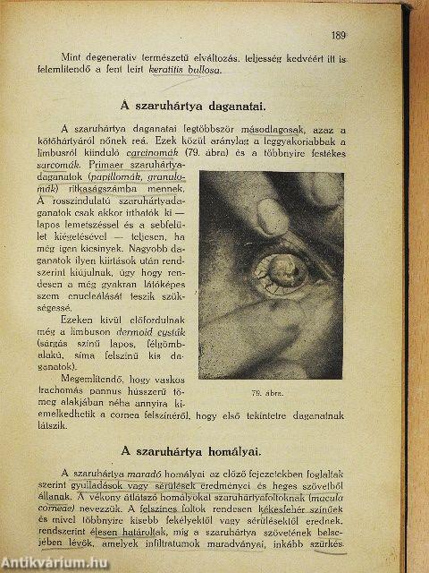 Gyakorlati szemészet