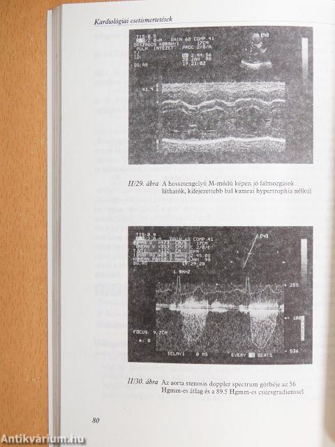 Kardiológiai esetismertetések