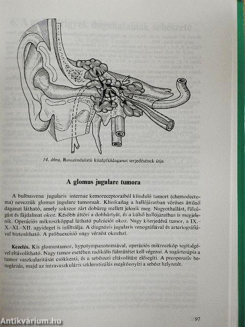 A daganatok sebészete
