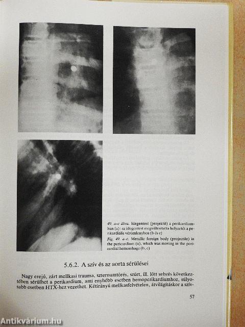 Baleseti röntgendiagnosztika gyermekkorban