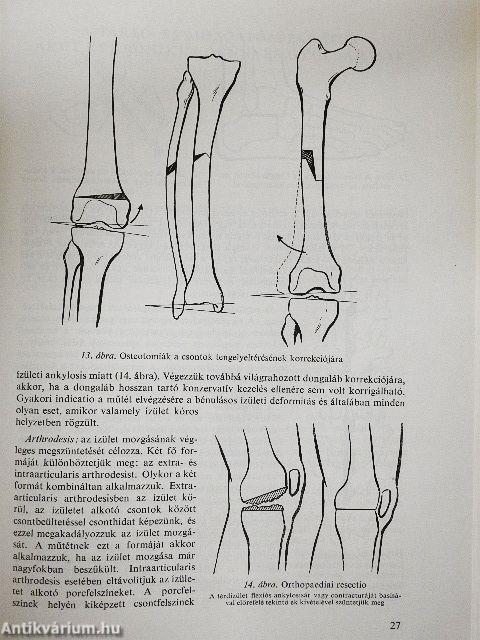Az orthopaedia tankönyve