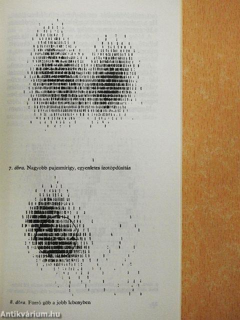 Pajzsmirigybetegségek