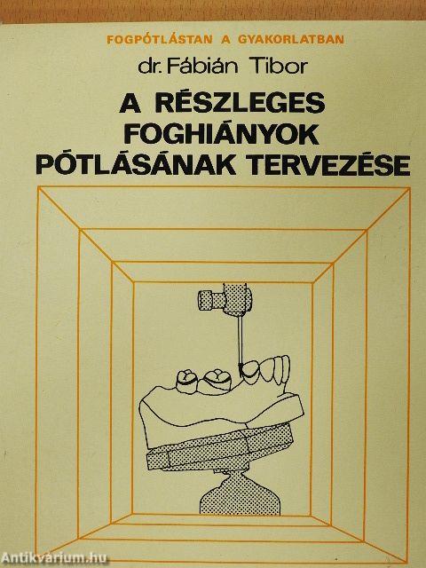 A részleges foghiányok pótlásának tervezése