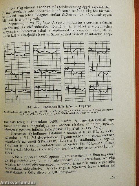 Elektrokardiográfia