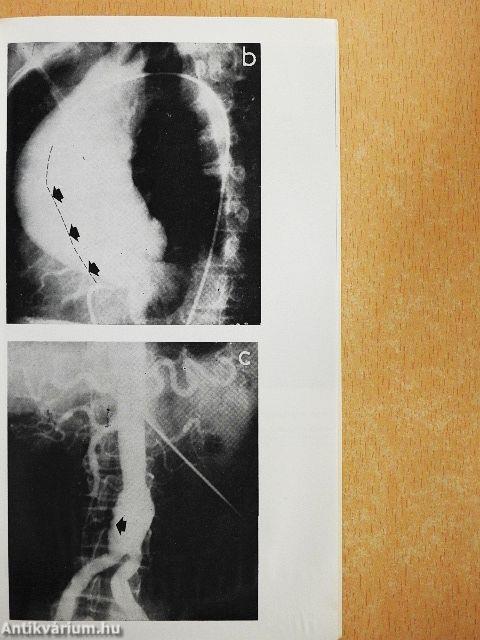 Érsebészeti vezérfonal