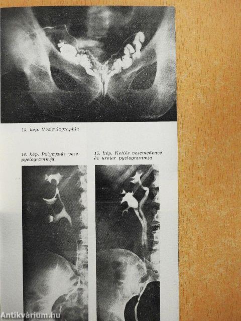 A gyakorló orvos urologiája