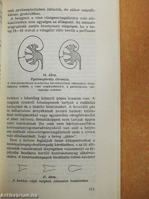 A röntgenvizsgálatok racionális javallatai