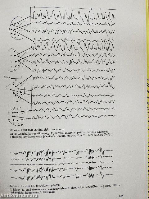 Belbetegségek elkülönítő diagnózisa 1-3.