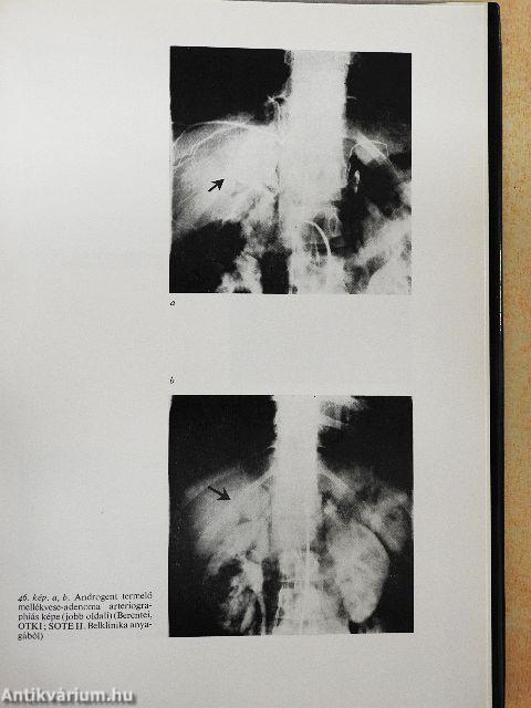 Klinikai endocrinologia 1-2.