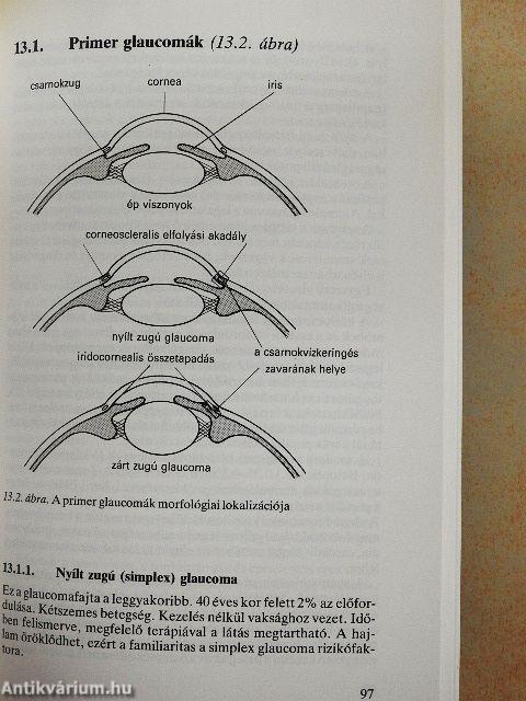 Szemészeti praktikum