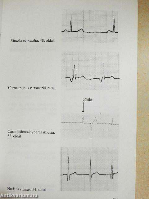 EKG a sürgősségi ellátásban