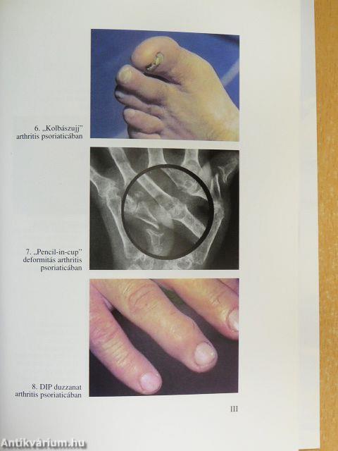 Gyakorlati reumatológia