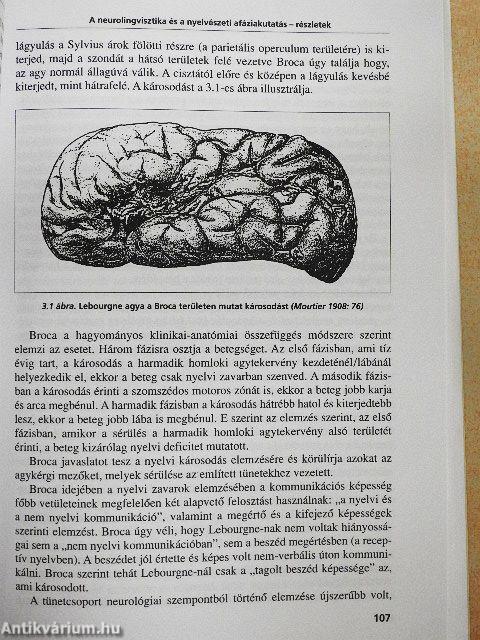 Nyelvi struktúrák és az agy