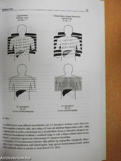 Computer tomográfia